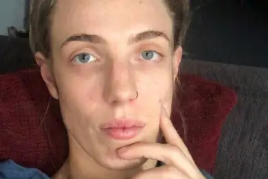 Новый симптом COVID обнаружили в Австралии