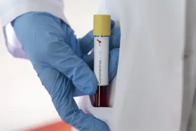 Тесты на коронавирус нужно делать всем бессимптомным — медики