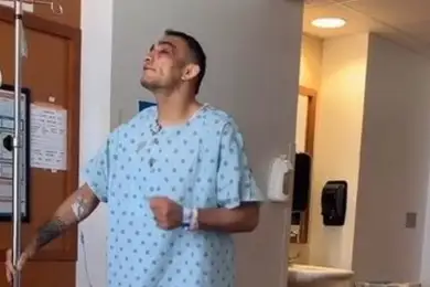 Тони Фергюсон станцевал с синяками на лице