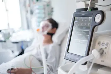 Казахстан имеет более 2500 аппаратов искусственной вентиляции легких