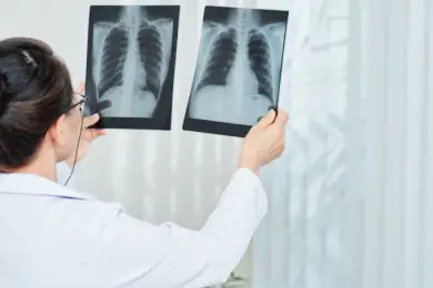 «Загадочная пневмония» в Казахстане: не спешите с выводами — ООН