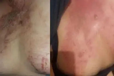 «Оторвал ей сосок на груди, пинал и надругался»: в шокирующем скандале замешаны полиция и врачи Алматы