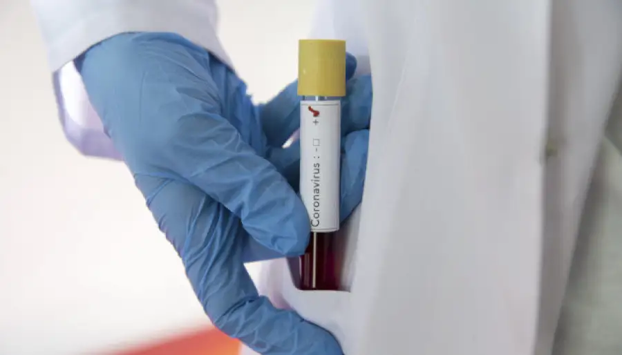 Тесты на коронавирус нужно делать всем бессимптомным — медики